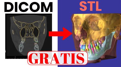 pasar de obj a stl|convertir dicom en stl.